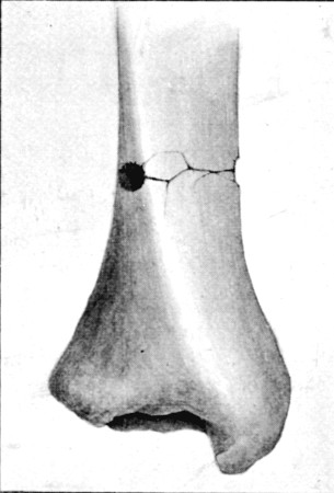 Fig. 57.