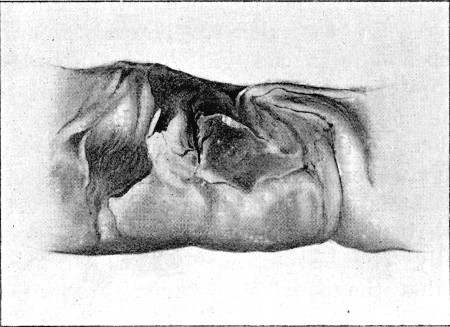 Fig. 85.