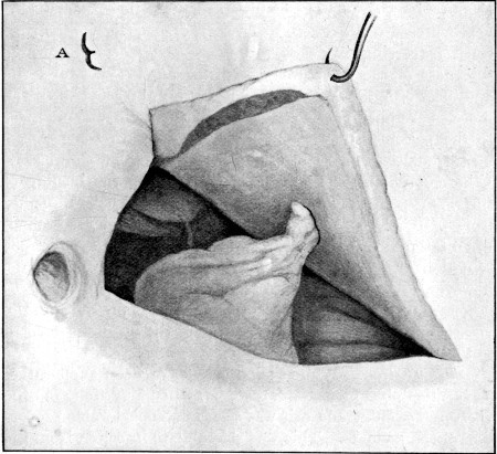 Fig. 89.