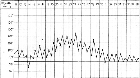 Temperature Chart 4.