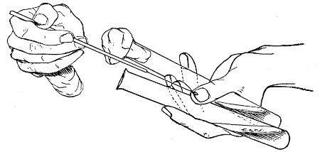 Fig. 117.—Inoculating tubes, seen from the front.