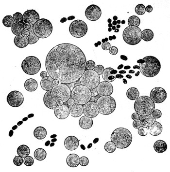 Fig. 5. Microscopic appearance of milk showing relative
size of fat globules and bacteria.