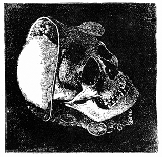 The skull described above.