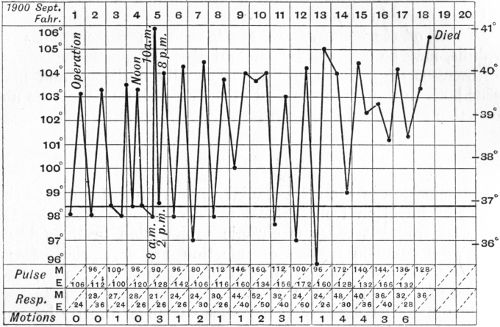 Fig. 196.—Chart of case of Sinus Phlebitis following
middle ear disease in a boy æt. 13.