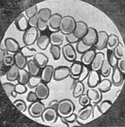 PIG'S BLOOD MAGNIFIED MANY TIMES.