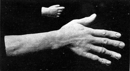 THE HANDS OF "TOM THUMB" AND LOUSHKIN, THE RUSSIAN
GIANT.