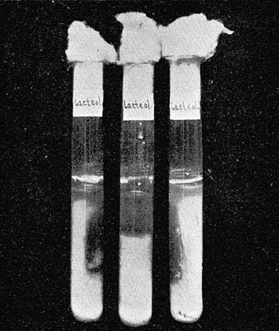 Photograph of Test-Tubes of Sterile Milk, Inoculated with a Tablet Preparation Said to Contain Pure Cultures