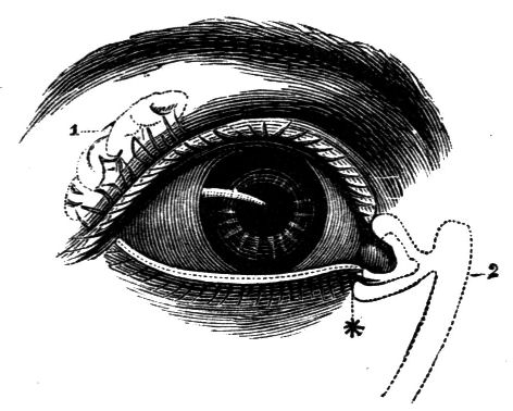 Fig. 47.--Front View of Right Eye.