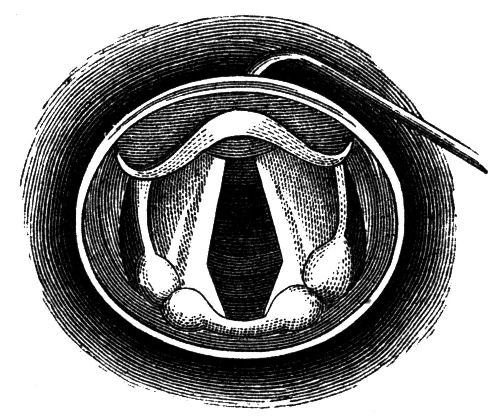 Fig. 56. A View of the Vocal Cords