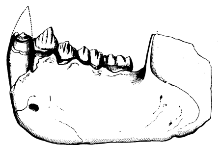 Lower Jaw of Dryopithecus
  Fontani.