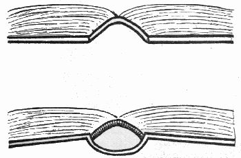 Figure 13.—Tight back and loose back.