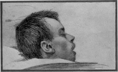 Sketch of G. W. James brought home wounded from the assault on Fort Wagner