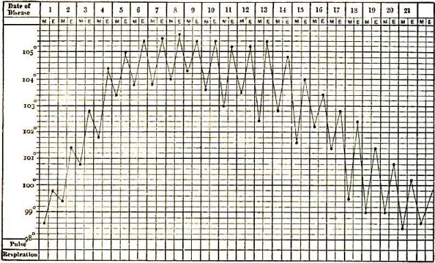 Typhoid temperature chart
