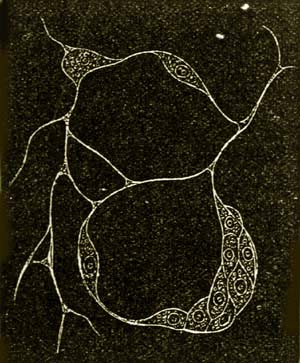 Labyrinthula macrocystis.