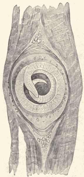 Trichina spiralis.