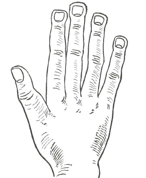 Fig. 23

SPATULATE HAND