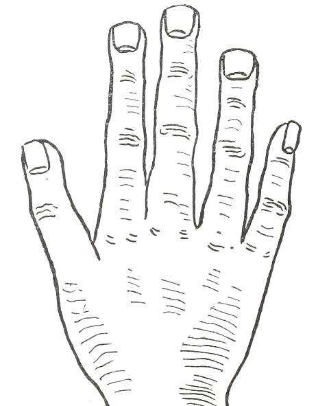Fig. 24

SQUARE HAND