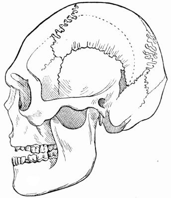 Borreby Skull