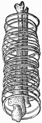 Fore-arm, encircled with Bracelets