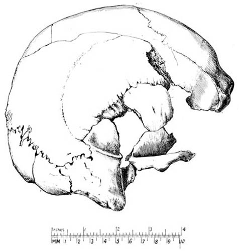 Drawing of a skull