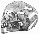 No. 153. Skull of a Woman, found near some gold ornaments
in the Lowest Stratum (13 M.).