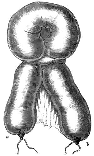 Anterior view of the strangulated intestine