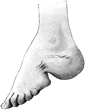 Foot of Chinese Woman