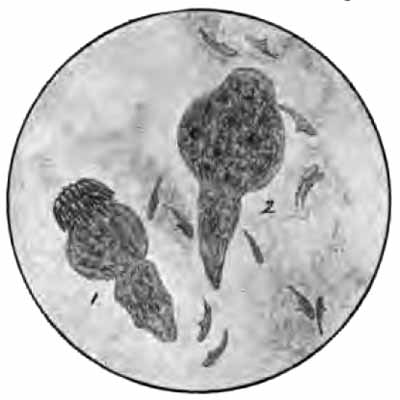 Scolex of tnia echinococcus