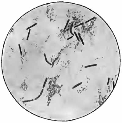 Boas-Oppler bacillus