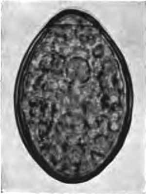 Egg of Bothriocephalus latus