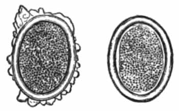 Eggs of Ascaris lumbricoides