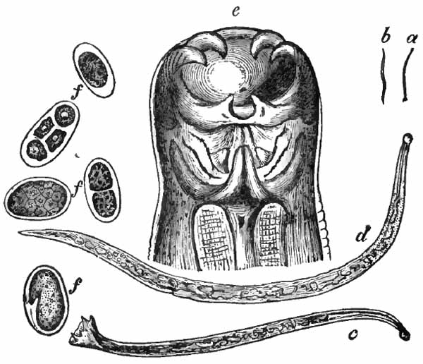 Uncinaria duodenalis
