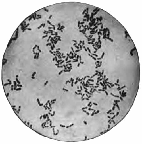Bacillus diphtheri