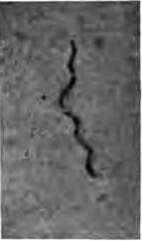 Spirochte refringens