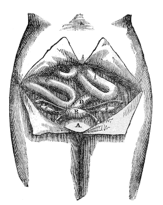 Front
View of the Female Pelvis