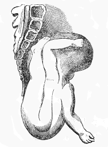 Descent
of the shoulder and trunk
