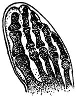 X-RAY OF FOOT

Properly housed in form fitting shoes