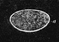 Illustration: Bothriocephalus latus, egg