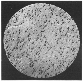 Photo, Cornell University Medical School


MICROPHOTOGRAPH OF BRAIN TISSUE