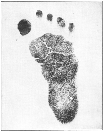THE BABY’S FOOTPRINT

A means of positive identification