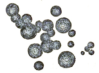Dark globules of leucine