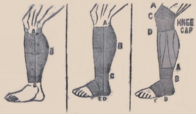 Elastic stockings and knee caps