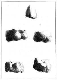 Tooth crowns found in an Etruscan
tomb