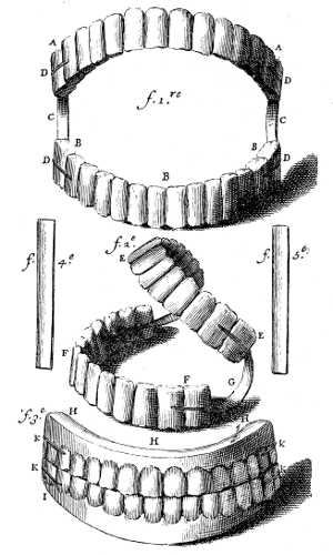Complete dentures (Fauchard).