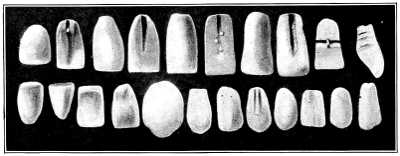 Earliest specimens of mineral teeth.