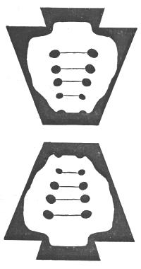 Sacrum bone and inverted sacrum