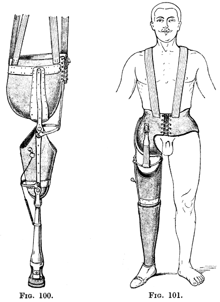 The Project Gutenberg eBook of Artificial Limbs, by A. Broca