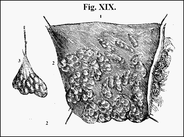  Fig. XIX.