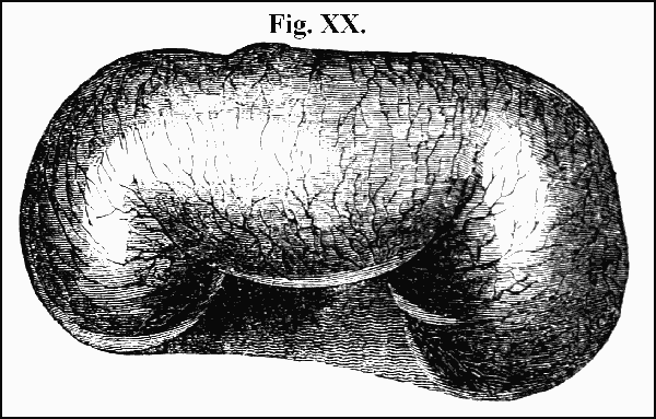 Fig. XX.