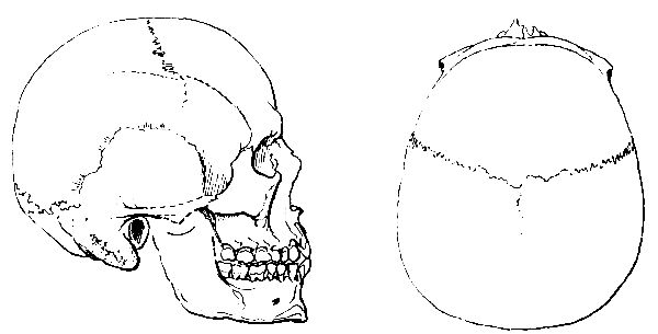 Brachycephalic Skull